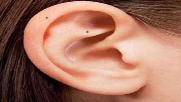 According to astrology, having a mole on the ear means this! Know complete information